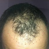 Planung für Ihr Zweithaar