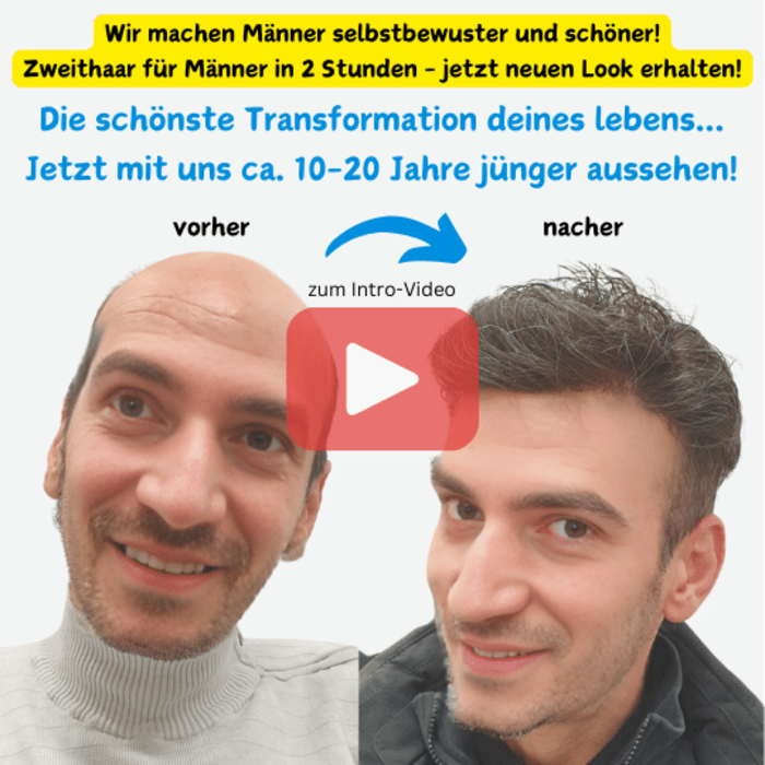 Hair transformation hair loss before after full hair - Top Secret Hair Design - Youtube Video