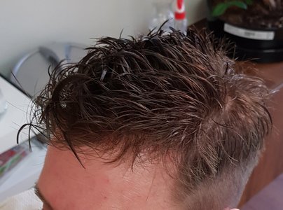 Nahaufnahme des Haaransatzes